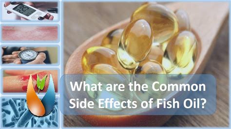 can fish oil cause gastritis.